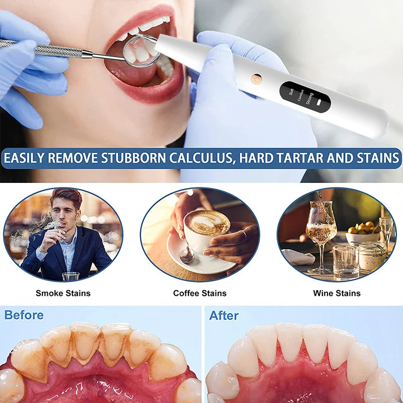 ULTRASONIC Electric Dental Scaler Oral Hygiene Kit Teeth Calculus Plaque Remover for Teeth